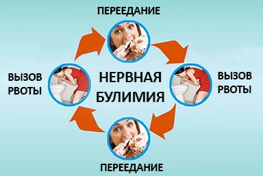 Лечение булимии в Миасском